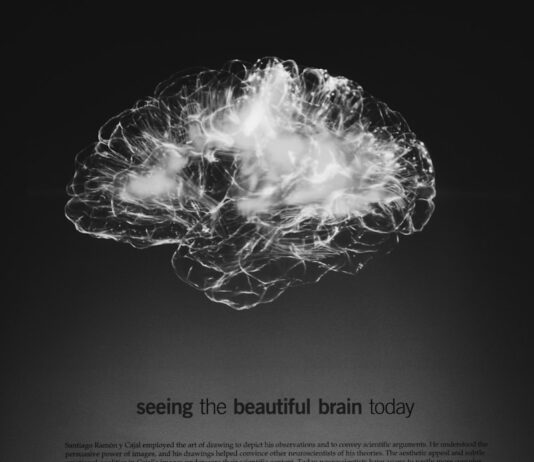 뇌건강 지키는 습관, 일상 속 작은 변화가 큰 차이를 만든다 a black and white photo of a brain